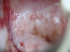 Fig. 10. VIAC+; HIV-; Possible use of herbs